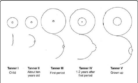 Breast Development in Pubescent Girls .